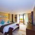 Otros